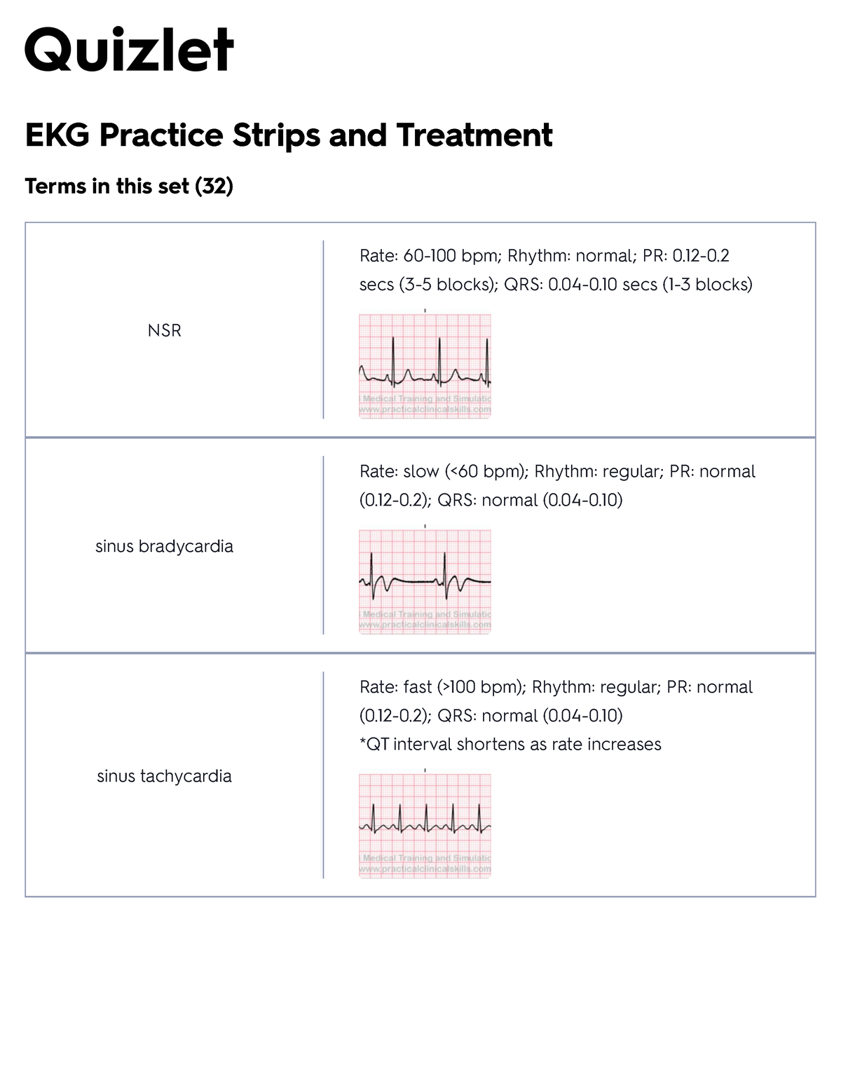 Free Printable Ekg Practice Strips